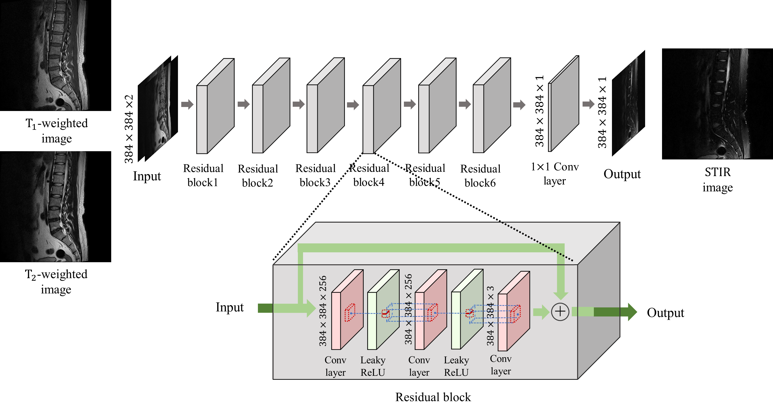 ISMRM 2020 Figure